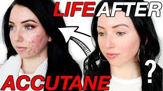 Was it Worth it 6 Months POSTACCUTANE  Lasting Side Effects Scarring Breakouts Coming Back [upl. by Atterg]