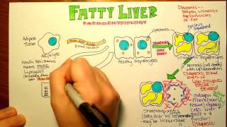 Fatty Liver Pathophysiology [upl. by Hyacinthe]