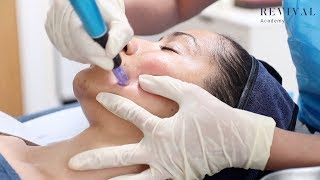 Microneedling Full Training Video [upl. by Kelda]