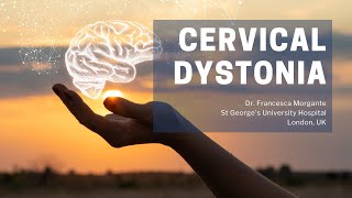 Cervical Dystonia Spasmodic Torticollis New Treatment Dr Demerjian TMJCONNECTION Case 13 [upl. by Ennairak]