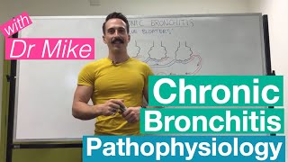 Chronic Bronchitis  Respiratory System [upl. by Delcina]