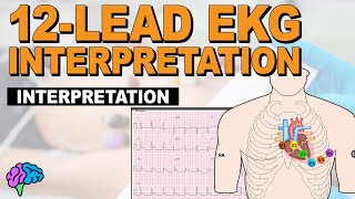 The SIMPLE Steps of 12Lead EKG Interpretation  EXPLAINED CLEARLY [upl. by Yrnehnhoj]