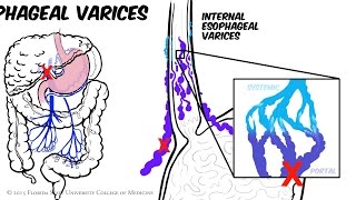 How To Do The Clamshell Exercise  Kinetic Sports Rehab [upl. by Lewison]