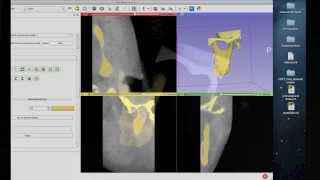 Tutorial Preparing Data for 3D Printing Using 3D Slicer [upl. by Esinrahs]