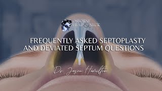 Septoplasty Frequently Asked Questions by Dr Jason S Hamilton [upl. by Ztnahc878]