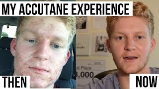 My Experience taking Accutane for 8 months [upl. by Bilow]