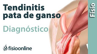 Cómo saber si tengo tendinitis de la pata de ganso [upl. by Aihsemat]