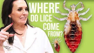 how to check for lice [upl. by Annala300]