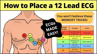 12 Lead ECG Placement MADE EASY EMT Nursing Paramedic ecg nursing [upl. by Fabe]