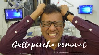 Guttapercha Removal  Easy technique to remove guttapercha in retreatment cases [upl. by Yartnoed777]