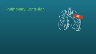 Chest Trauma Pulmonary Contusion [upl. by Acinorehs]