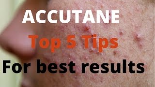 Accutane 5 tips by Dermatologists [upl. by Henrie]