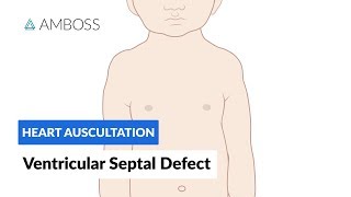 Ventricular Septal Defect VSD  Heart Auscultation  Episode 11 [upl. by Ardnusal]