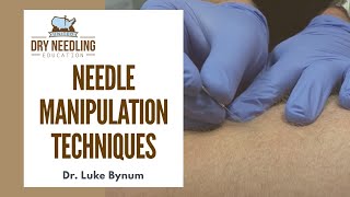 Dry Needling Needle Manipulation Techniques [upl. by Delaryd]