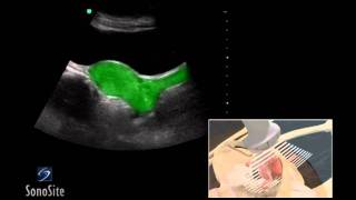 How To Female Pelvis Ultrasound Exam 3D Video [upl. by Meredeth]