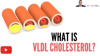 ► What Is VLDL Cholesterol   by Dr Sam Robbins [upl. by Vez]