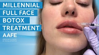 Classic Millennial Full Face Botox Treatment  AAFE [upl. by Arej]