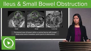 Epithelial Tissue उपकला ऊतक in hindi Type of Epithelial Tissue  ssc campus [upl. by Buine]