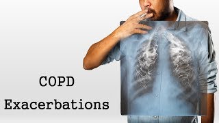 COPD Exacerbations [upl. by Leonanie]