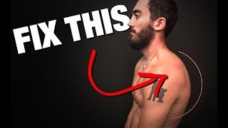 How to Fix Rounded Shoulders GONE IN 4 STEPS [upl. by Drusus]