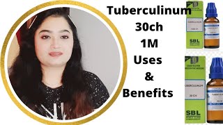 Homeopathic Medicine Tuberculinum 30 and 1M Uses In Hindi By Anusuya Chakrabarti [upl. by Tawnya]