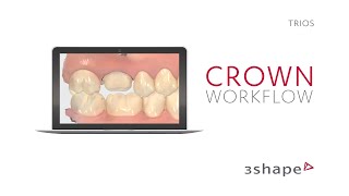 3Shape TRIOS  Crown Workflow [upl. by Regdor]