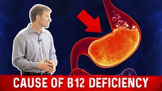 Vitamin B12 Deficiency The most common Cause – Dr Berg [upl. by Scibert]