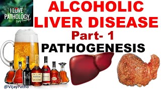 ALCOHOLIC LIVER DISEASE Part 1 Pathogenesis [upl. by Afatsom]