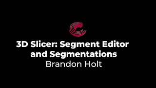 3D Slicer  Segment Editor and Segmentations [upl. by Snyder]