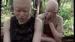 Deadly Hunt Albinos in Tanzania [upl. by Constant]